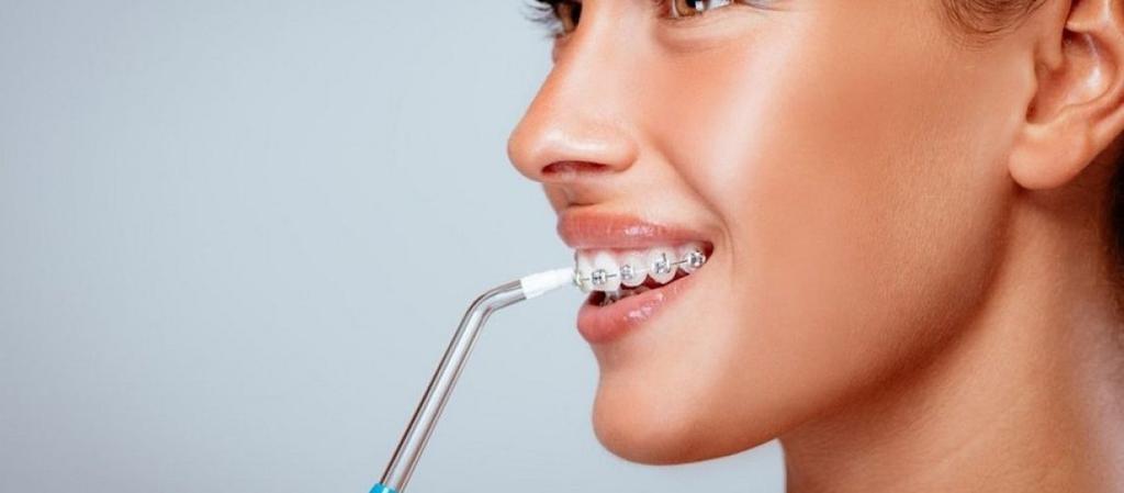 Іригатор – ефективний засіб гігієни порожнини рота.