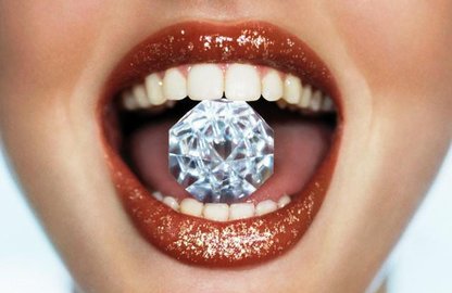 Зубний камінь: надясенний та підясенний