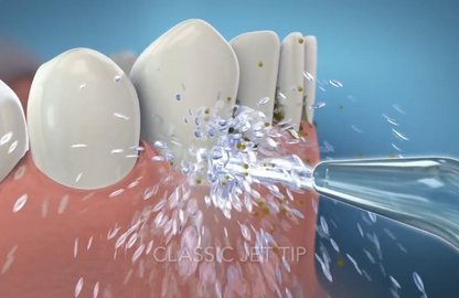 Іригатор для пацієнтів з обмеженими фізичними можливостями