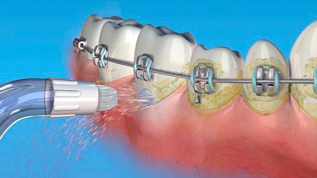 Рідина для іригації